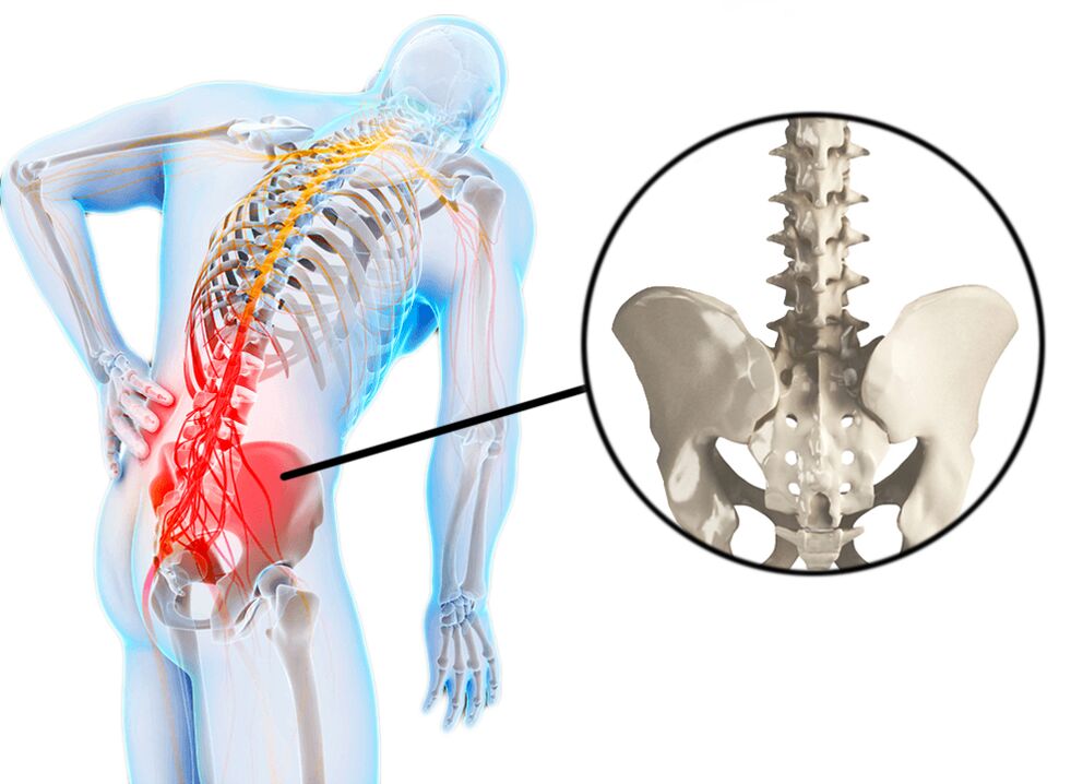 Las patologías de la columna son una causa común de dolor lumbar. 