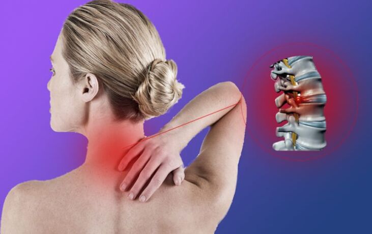 Inflamación de la columna con osteocondrosis cervical