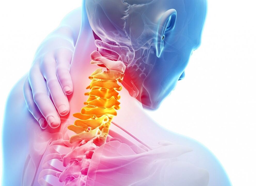 ¿Qué es la osteocondrosis cervical