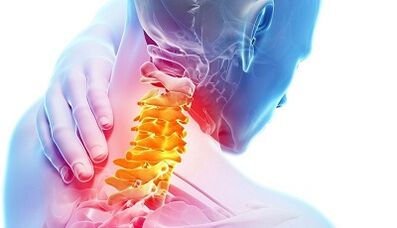 Causas de osteocondrosis cervical