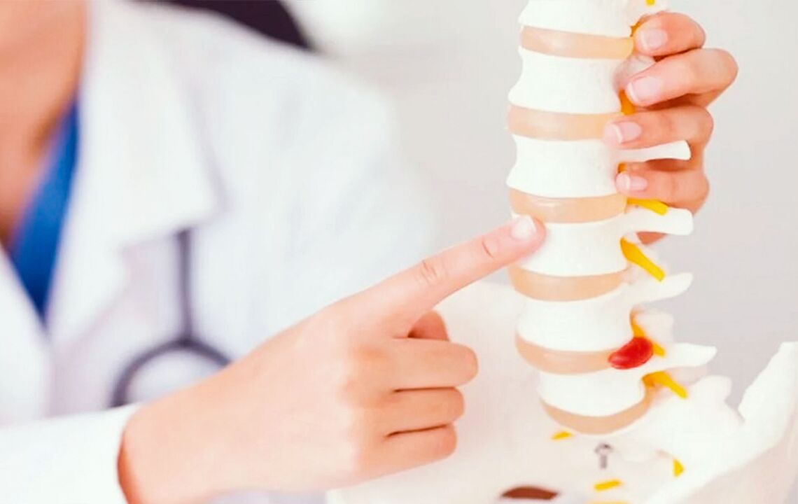 Daño a la columna vertebral debido a la osteocondrosis cervical.