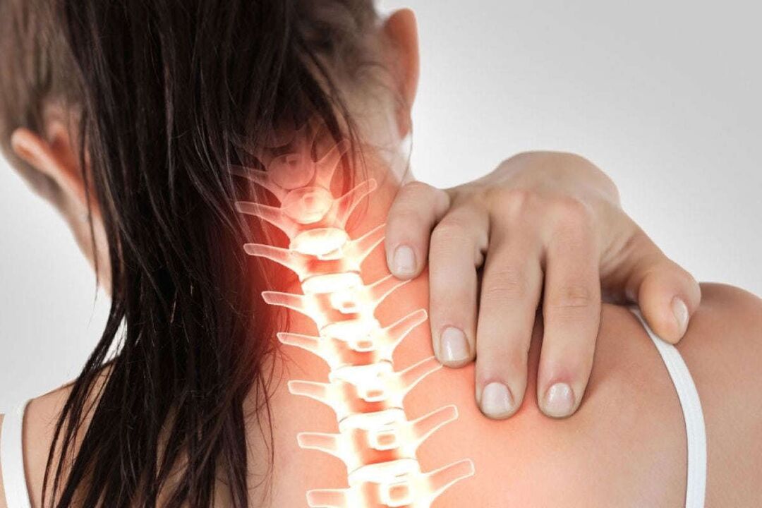 manifestaciones de osteocondrosis cervical