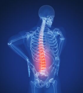 columna lumbar y osteocondrosis